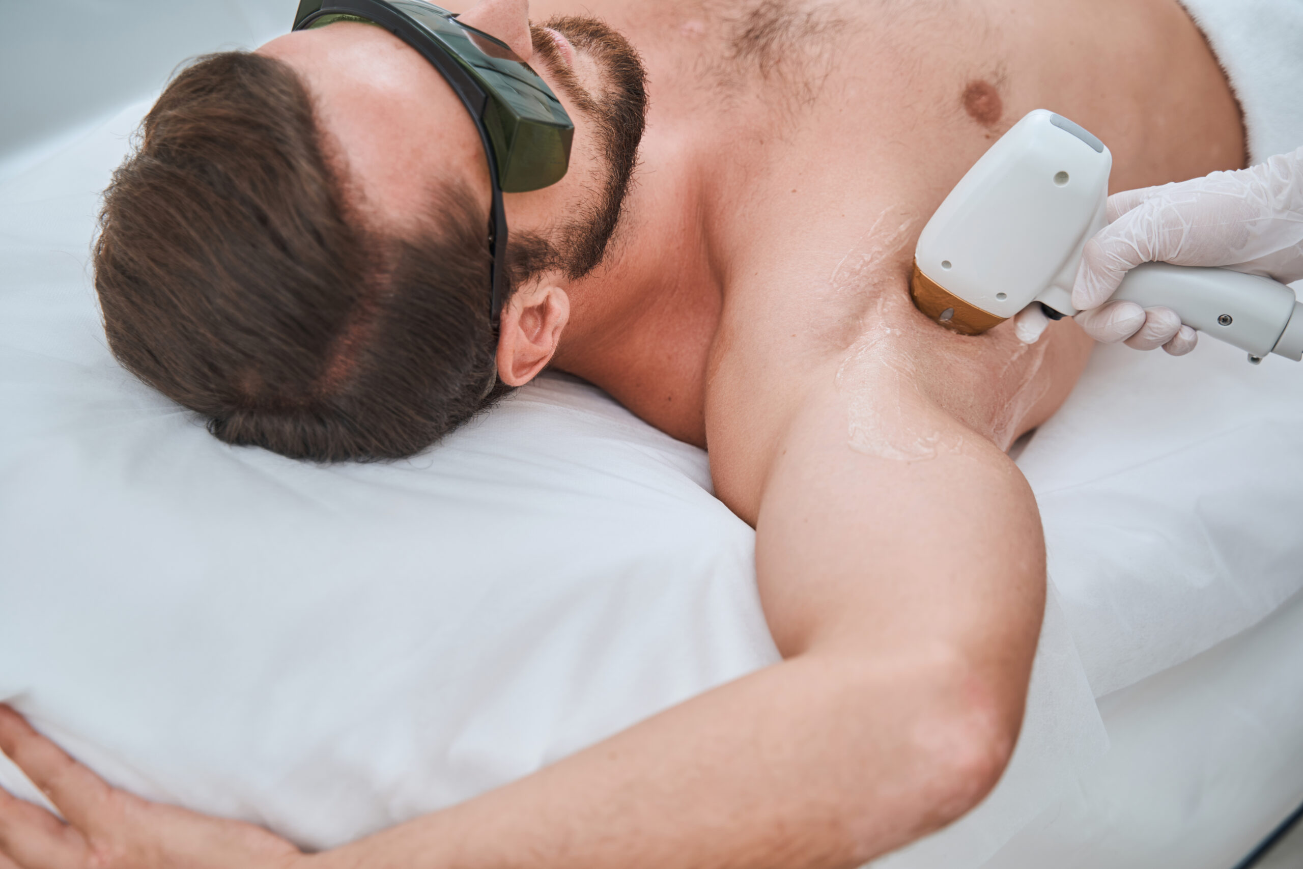 epilazione laser a diodo a Lodi